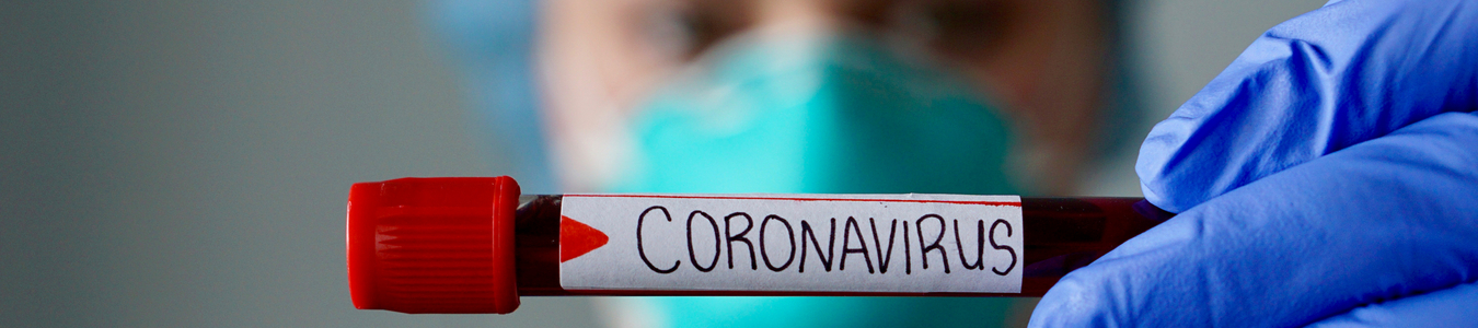 Het coronavirus: wat te doen als u een reis heeft geboekt?